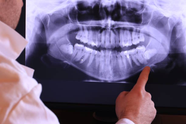Best Emergency Gum Treatment in Bellows Falls, VT