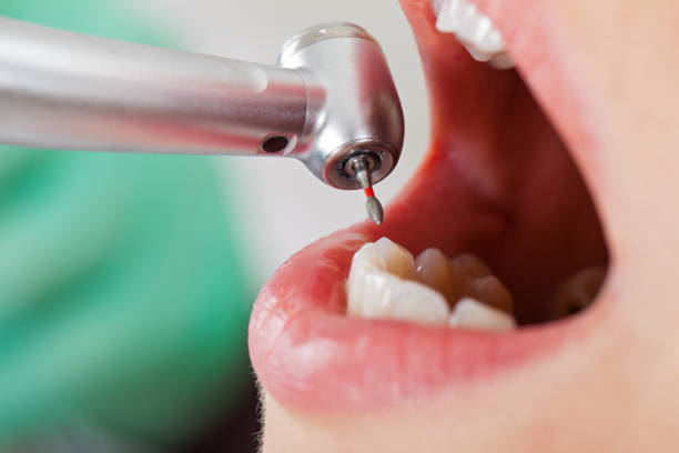 Best Same-Day Emergency Dental Services in Bellows Falls, VT